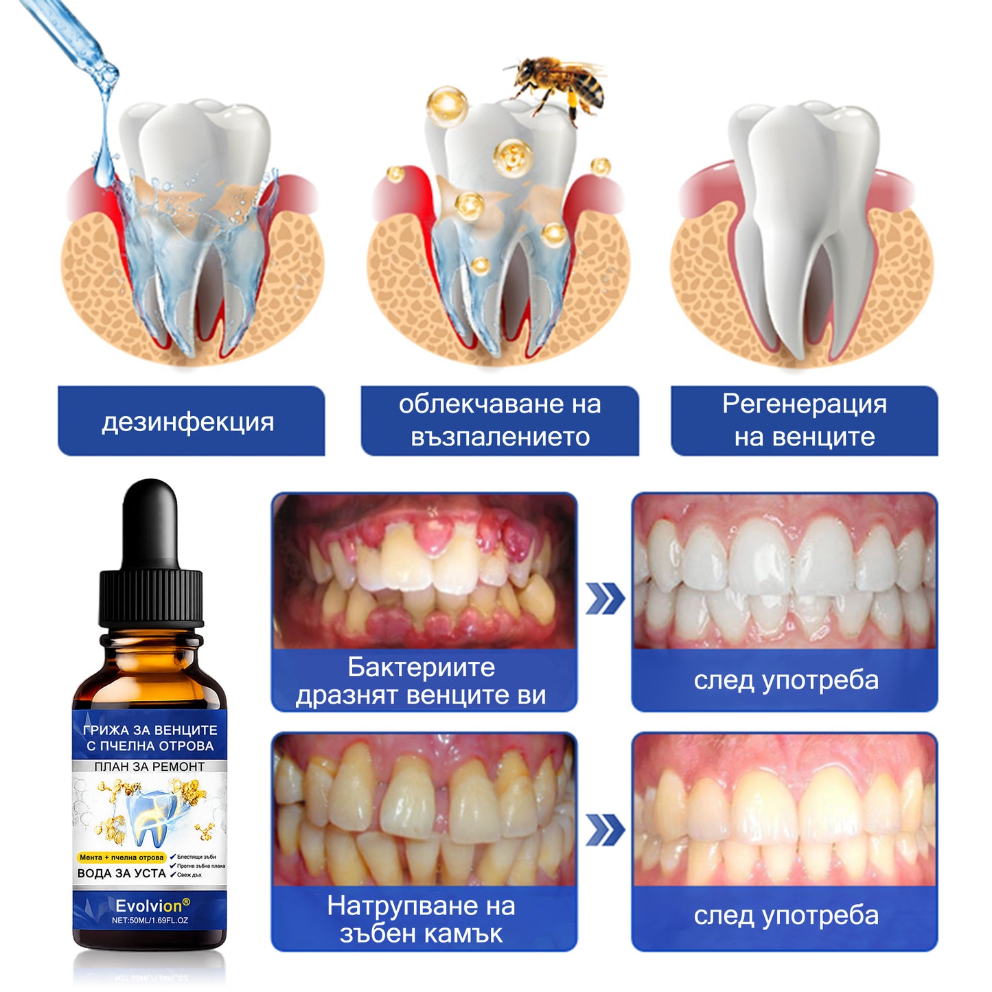 🦷 Evolvion® VioGloss terapia ústnej hygieny s včelím jedom 🦷 (🇸🇰 Na každodennú starostlivosť o ústnu dutinu)