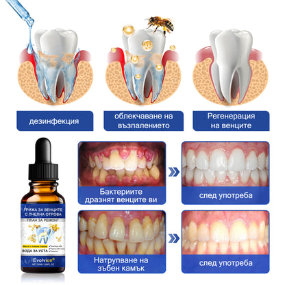 🦷 Evolvion® VioGloss terapia ústnej hygieny s včelím jedom 🦷 (🇸🇰 Na každodennú starostlivosť o ústnu dutinu)