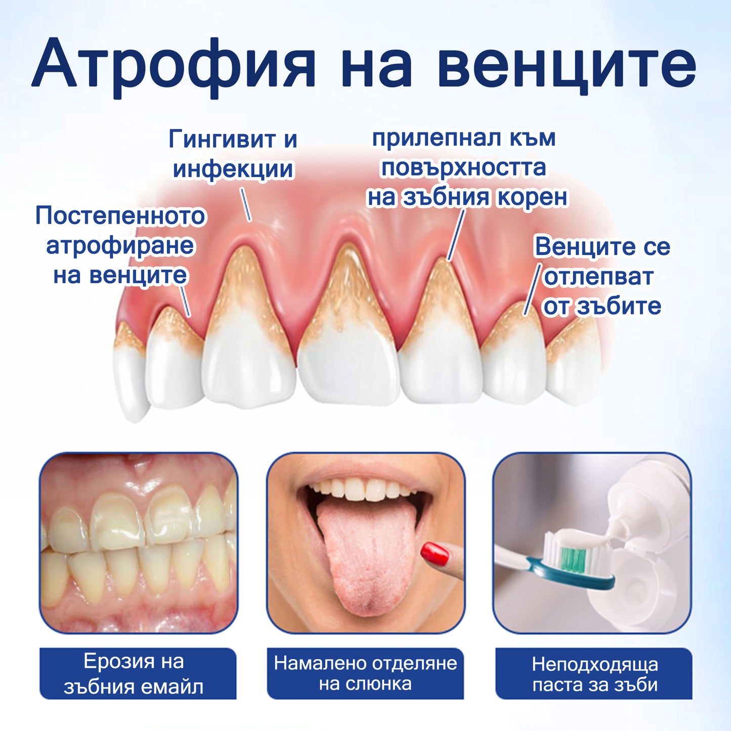 🦷 Evolvion® VioGloss terapia ústnej hygieny s včelím jedom 🦷 (🇸🇰 Na každodennú starostlivosť o ústnu dutinu)