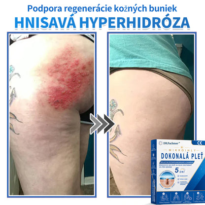 🫶📕 Náplasť DR.Fachmer® 2 v 1 s mikroihličkami a hydrokoloidom |👉 Odstraňovač vyvýšených materských znamienok, akné, plochých bradavíc a kožných výrastkov | Zlepšuje vrásky, jazvy a škvrny | Neviditeľné náplasti na pupienky na tvár a telo