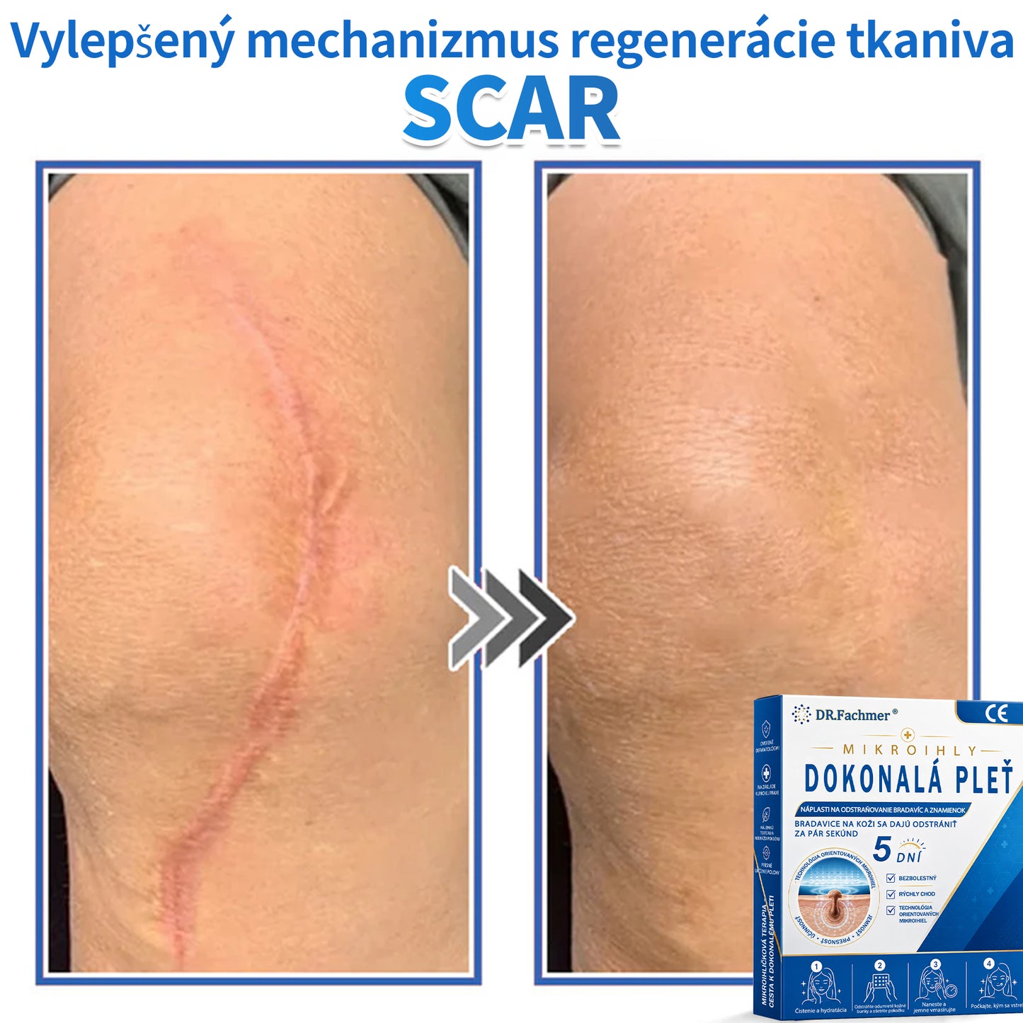 🫶📕 Náplasť DR.Fachmer® 2 v 1 s mikroihličkami a hydrokoloidom |👉 Odstraňovač vyvýšených materských znamienok, akné, plochých bradavíc a kožných výrastkov | Zlepšuje vrásky, jazvy a škvrny | Neviditeľné náplasti na pupienky na tvár a telo