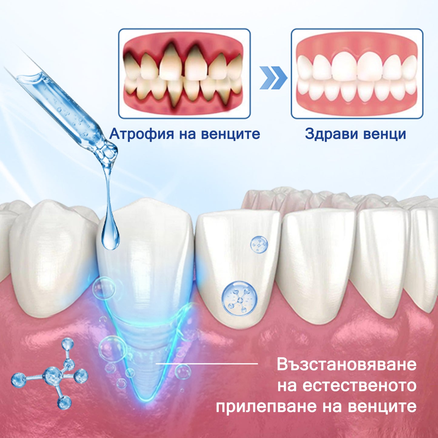 🦷 Evolvion® VioGloss terapia ústnej hygieny s včelím jedom 🦷 (🇸🇰 Na každodennú starostlivosť o ústnu dutinu)