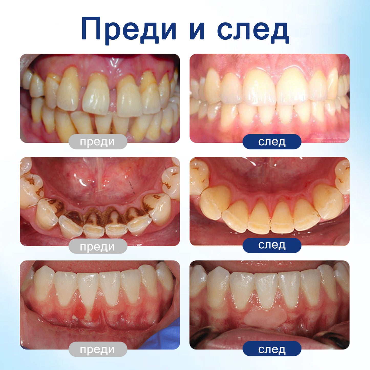 🦷 Evolvion® VioGloss terapia ústnej hygieny s včelím jedom 🦷 (🇸🇰 Na každodennú starostlivosť o ústnu dutinu)