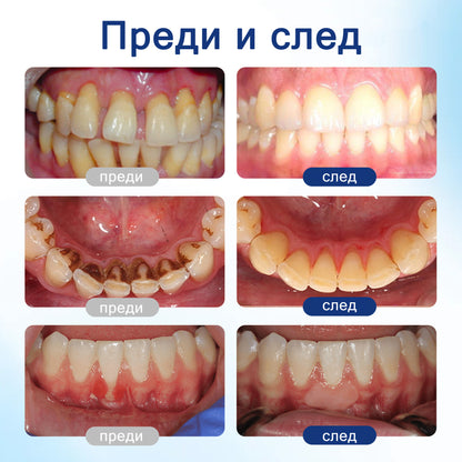 🦷 Evolvion® VioGloss terapia ústnej hygieny s včelím jedom 🦷 (🇸🇰 Na každodennú starostlivosť o ústnu dutinu)