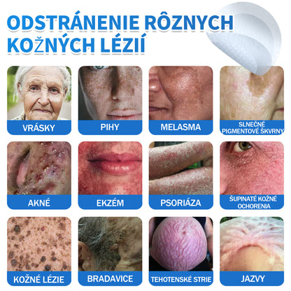 🫶📕 Náplasť DR.Fachmer® 2 v 1 s mikroihličkami a hydrokoloidom |👉 Odstraňovač vyvýšených materských znamienok, akné, plochých bradavíc a kožných výrastkov | Zlepšuje vrásky, jazvy a škvrny | Neviditeľné náplasti na pupienky na tvár a telo