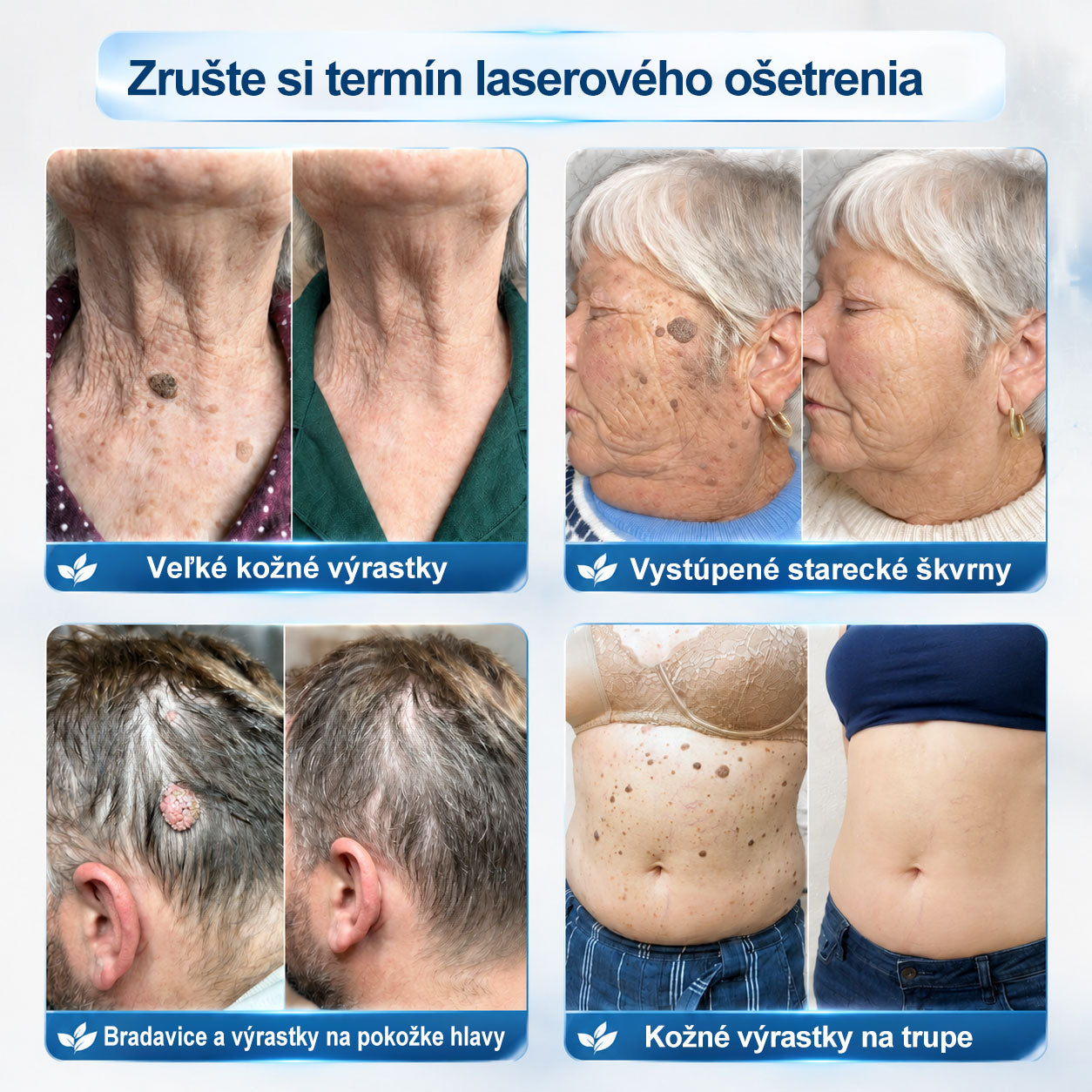 𝑶𝒇𝒊𝒄𝒊á𝒍𝒏𝒚 𝒐𝒃𝒄𝒉𝒐𝒅 ✅️ | GFOUK® 7-𝒅ň𝒐𝒗ý 𝒑𝒓í𝒑𝒓𝒂𝒗𝒐𝒌 𝒏𝒂 𝒐𝒅𝒔𝒕𝒓á𝒏𝒆𝒏𝒊𝒆 𝒌𝒐ž𝒏ý𝒄𝒉 𝒗ý𝒓𝒂𝒔𝒕𝒌𝒐𝒗 𝒂 𝒑𝒊𝒈𝒎𝒆𝒏𝒕𝒐𝒗ý𝒄𝒉 š𝒌𝒗ŕ𝒏👩‍⚕️ (𝒃𝒆𝒛 𝒃𝒐𝒍𝒆𝒔𝒕𝒊, 𝒃𝒆𝒛 𝒋𝒂𝒛𝒊𝒆𝒗, 𝒑𝒓𝒆𝒔𝒏ý 𝒓𝒐𝒍𝒍-𝒐𝒏 𝒂𝒑𝒍𝒊𝒌á𝒕𝒐𝒓) 🔥