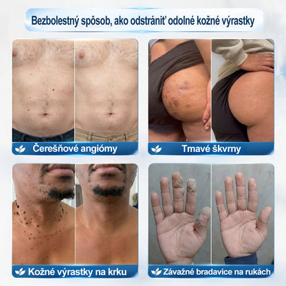 𝑶𝒇𝒊𝒄𝒊á𝒍𝒏𝒚 𝒐𝒃𝒄𝒉𝒐𝒅 ✅️ | GFOUK® 7-𝒅ň𝒐𝒗ý 𝒑𝒓í𝒑𝒓𝒂𝒗𝒐𝒌 𝒏𝒂 𝒐𝒅𝒔𝒕𝒓á𝒏𝒆𝒏𝒊𝒆 𝒌𝒐ž𝒏ý𝒄𝒉 𝒗ý𝒓𝒂𝒔𝒕𝒌𝒐𝒗 𝒂 𝒑𝒊𝒈𝒎𝒆𝒏𝒕𝒐𝒗ý𝒄𝒉 š𝒌𝒗ŕ𝒏👩‍⚕️ (𝒃𝒆𝒛 𝒃𝒐𝒍𝒆𝒔𝒕𝒊, 𝒃𝒆𝒛 𝒋𝒂𝒛𝒊𝒆𝒗, 𝒑𝒓𝒆𝒔𝒏ý 𝒓𝒐𝒍𝒍-𝒐𝒏 𝒂𝒑𝒍𝒊𝒌á𝒕𝒐𝒓) 🔥